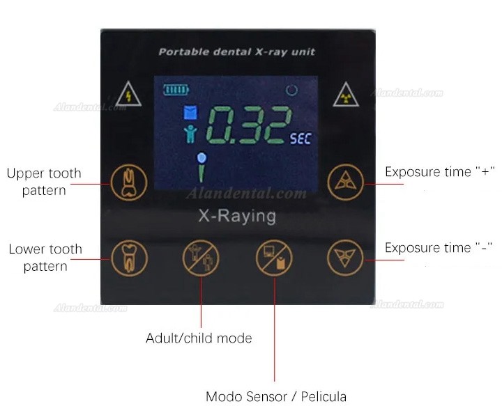 Portable Dental X-Ray Unit Machine RAY-100 Handheld Digital Xray Imaging System (Colorful Touch Screen)